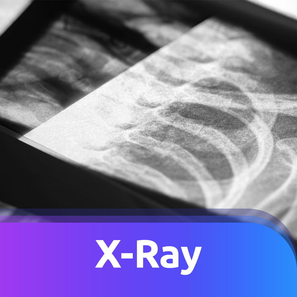 Nikki x-ray